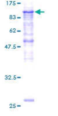 12.5% SDS-PAGE Stained with Coomassie Blue.