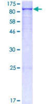 12.5% SDS-PAGE Stained with Coomassie Blue.