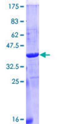 12.5% SDS-PAGE Stained with Coomassie Blue.