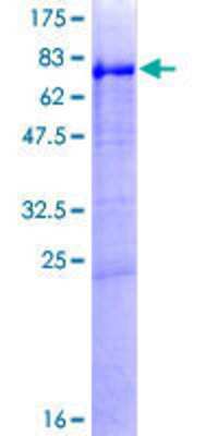 12.5% SDS-PAGE Stained with Coomassie Blue.