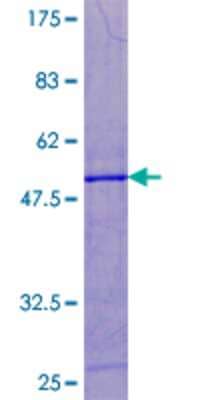 12.5% SDS-PAGE Stained with Coomassie Blue.