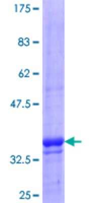 12.5% SDS-PAGE Stained with Coomassie Blue.