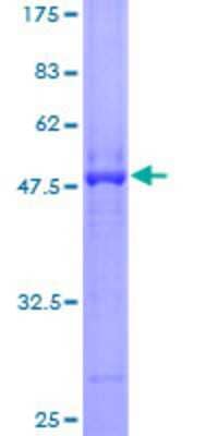 12.5% SDS-PAGE Stained with Coomassie Blue.