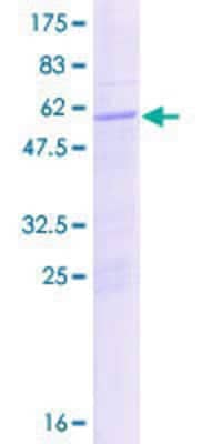 12.5% SDS-PAGE Stained with Coomassie Blue.