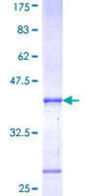 12.5% SDS-PAGE Stained with Coomassie Blue.