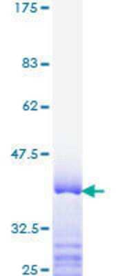 SDS-Page: Recombinant Human TRAP220/MED1 Protein [H00005469-Q01] - 12.5% SDS-PAGE Stained with Coomassie Blue.