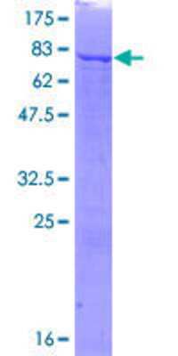 SDS-PAGE Recombinant Human Phosphoribosyl Pyrophosphate Amidotransferase GST (N-Term) Protein