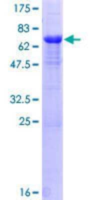 SDS-PAGE Recombinant Human PPP1R7 GST (N-Term) Protein