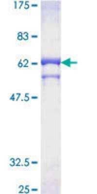 SDS-Page: Recombinant Human PPP2CB Protein [H00005516-P01] - 12.5% SDS-PAGE Stained with Coomassie Blue.