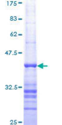 12.5% SDS-PAGE Stained with Coomassie Blue.