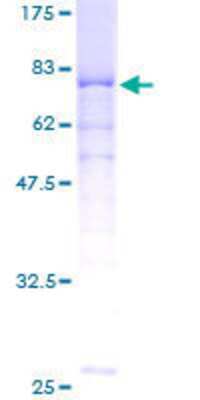 12.5% SDS-PAGE Stained with Coomassie Blue.