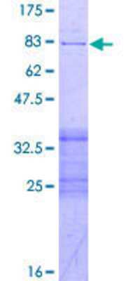 SDS-Page: Recombinant Human PPP2R2B Protein [H00005521-P02] - 12.5% SDS-PAGE Stained with Coomassie Blue.