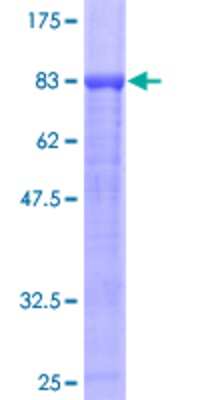 12.5% SDS-PAGE Stained with Coomassie Blue.