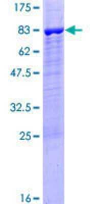 Other Recombinant Human PPP2R5B GST (N-Term) Protein