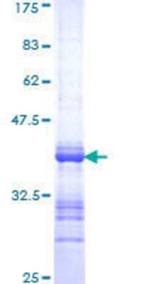 SDS-Page: Recombinant Human PPP3CB Protein [H00005532-Q01] - 12.5% SDS-PAGE Stained with Coomassie Blue.