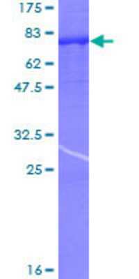 SDS-Page: Recombinant Human PPP3CC Protein [H00005533-P01] - 12.5% SDS-PAGE Stained with Coomassie Blue.