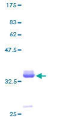 Recombinant Human Pancreatic Polypeptide/PP Protein [H00005539-P01] - 12.5% SDS-PAGE Stained with Coomassie Blue.