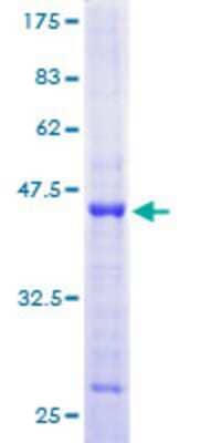 SDS-Page: Recombinant Human DNA Primase large subunit Protein [H00005558-P01] - 12.5% SDS-PAGE Stained with Coomassie Blue.