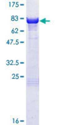 12.5% SDS-PAGE Stained with Coomassie Blue.