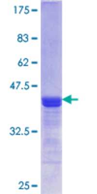 12.5% SDS-PAGE Stained with Coomassie Blue.