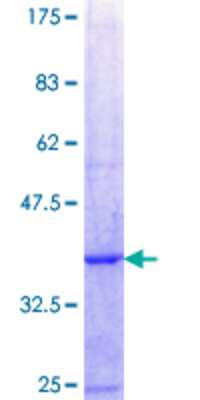 SDS-Page: Recombinant Human PAP39 Protein [H00005635-Q02] - 12.5% SDS-PAGE Stained with Coomassie Blue.