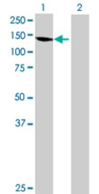 Lane 1: PSD transfected lysate (112.75 KDa) Lane 2: Non-transfected lysate.