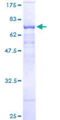 SDS-PAGE Recombinant Human PSG9 GST (N-Term) Protein