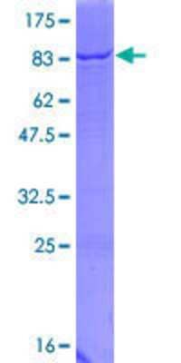 12.5% SDS-PAGE Stained with Coomassie Blue.