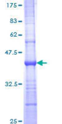12.5% SDS-PAGE Stained with Coomassie Blue.