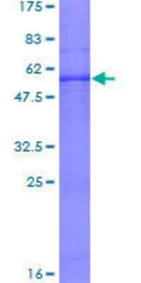 12.5% SDS-PAGE Stained with Coomassie Blue.