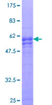 12.5% SDS-PAGE Stained with Coomassie Blue.