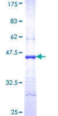 SDS-Page: Recombinant Human ALDH18A1 Protein [H00005832-Q01] - 12.5% SDS-PAGE Stained with Coomassie Blue.