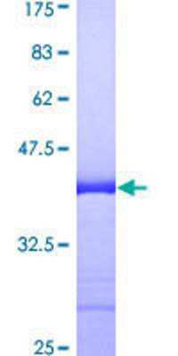 SDS-Page: Recombinant Human RGL2 Protein [H00005863-Q01] - 12.5% SDS-PAGE Stained with Coomassie Blue.