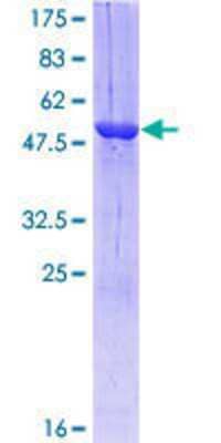 12.5% SDS-PAGE Stained with Coomassie Blue.