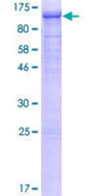 12.5% SDS-PAGE Stained with Coomassie Blue.