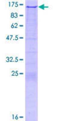 SDS-Page: Recombinant Human RAG1 Protein [H00005896-P01] - 12.5% SDS-PAGE Stained with Coomassie Blue.