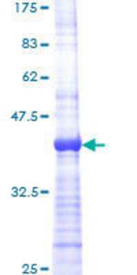 SDS-Page: Recombinant Human RALGDS Protein [H00005900-Q01] - 12.5% SDS-PAGE Stained with Coomassie Blue.