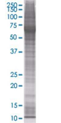 RARRES3 transfected lysate