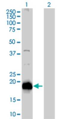 Lane 1: RARRES3 transfected lysate (18.15 KDa). Lane 2: Non-transfected lysate.