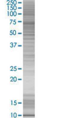 RARRES3 transfected lysate.
