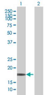 Lane 1: RARRES3 transfected lysate (18.2 KDa) Lane 2: Non-transfected lysate.
