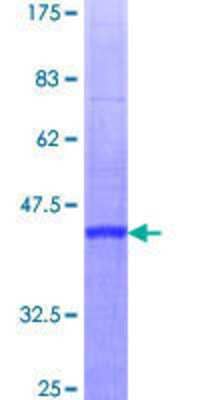 12.5% SDS-PAGE Stained with Coomassie Blue.