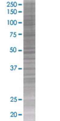 RBBP6 transfected lysate