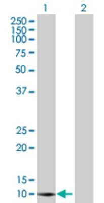 Lane 1: RBBP6 transfected lysate (13.2 KDa). Lane 2: Non-transfected lysate.