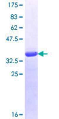 SDS-Page: Recombinant Human RENT1/UPF1/hUPF1 Protein [H00005976-Q01] - 12.5% SDS-PAGE Stained with Coomassie Blue.