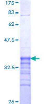 SDS-Page: Recombinant Human RFXAP Protein [H00005994-Q01] - 12.5% SDS-PAGE Stained with Coomassie Blue.