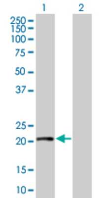 Lane 1: RGS1 transfected lysate (22.5 KDa) Lane 2: Non-transfected lysate.