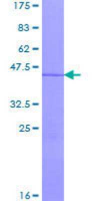 12.5% SDS-PAGE Stained with Coomassie Blue.
