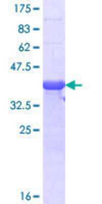 12.5% SDS-PAGE Stained with Coomassie Blue.