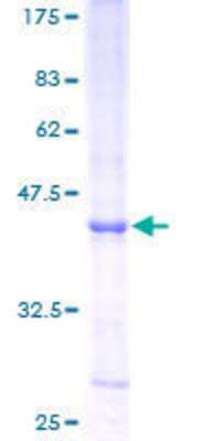 SDS-Page: Recombinant Human RNASE6 Protein [H00006039-P01] - 12.5% SDS-PAGE Stained with Coomassie Blue.